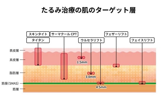 たるみ治療の肌のターゲット層