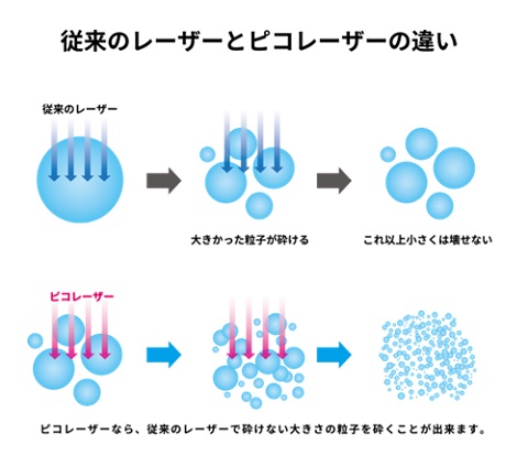 ピコレーザーと従来のレーザーとの違い