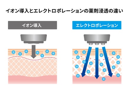 イオン導入とエレクトロポレーションの違い