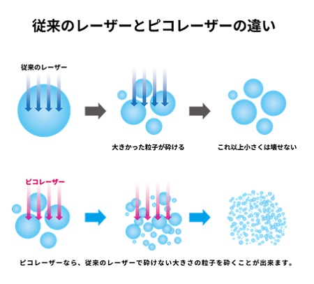 従来のレーザーとピコレーザーの違い