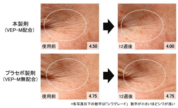  VEP-Mとプラセボの効果比較：肌での見た目