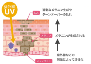 図解_シミができるメカニズム