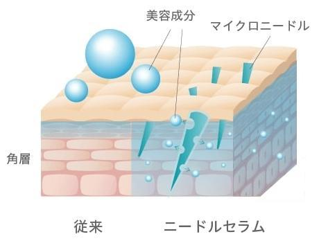 マイクロニードルの仕組みの図