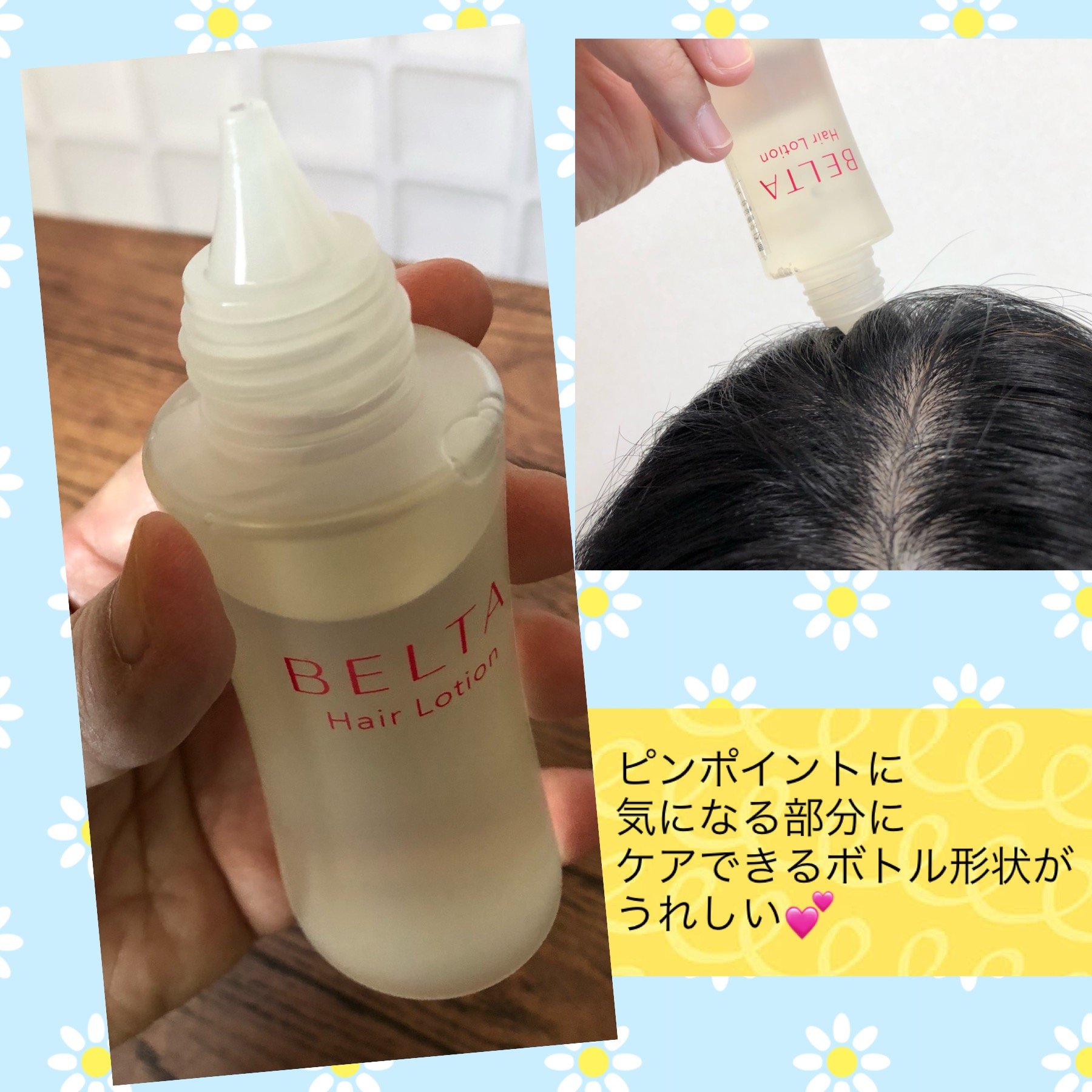 ベルタ薬用ヘアローション』〈医薬部外品〉を使ってみて by かのんかのんママりん |  エイジングケアを本気で学ぶ情報サイト｜ナールスエイジングケアアカデミー 『ベルタ薬用ヘアローション』〈医薬部外品〉を使ってみて by  かのんかのんママりん